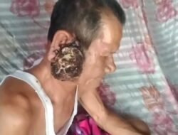 Ditengah Kemeriahan HUT Tubaba, Warga Tiyuh Penumangan Menderita Tumor Ganas Terkendala Biaya Berobat   